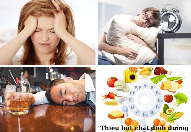 Nguyên nhân mắc suy nhược thần kinh
