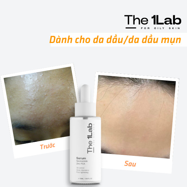 The 1Lab giúp cấp ẩm tức thì, làm dịu da nhanh