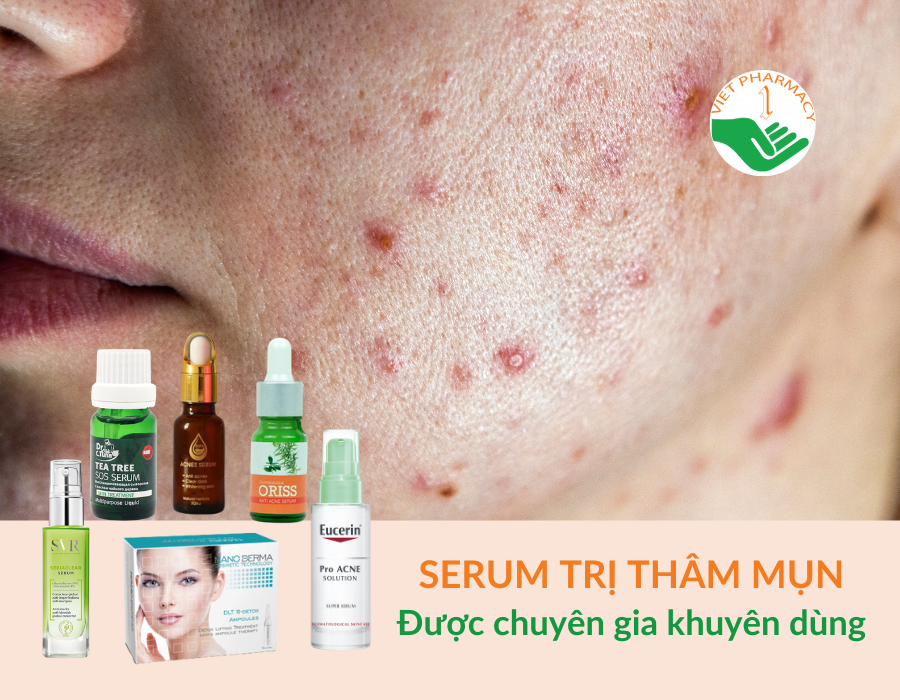 Top serum trị thâm mụn được chuyên gia khuyên dùng