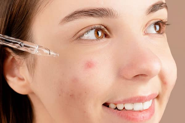 Serum trị thâm mụn có tốt không?