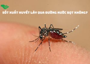 sot-xuat-huyet-lay-qua-duong-nuoc-bot-khong1