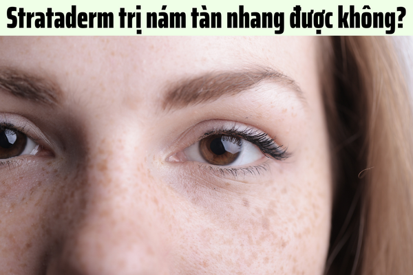 Strataderm có trị nám tàn nhang được không?