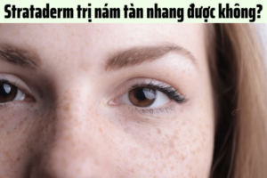 strataderm-tri-nam-tan-nhang-duoc-khong