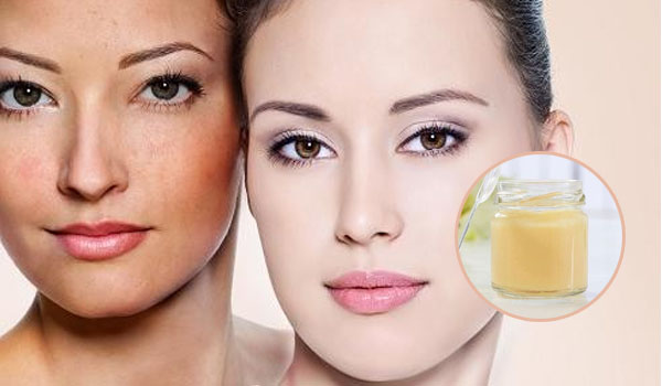 Sữa ong chúa có tác dụng đối với sắc đẹp