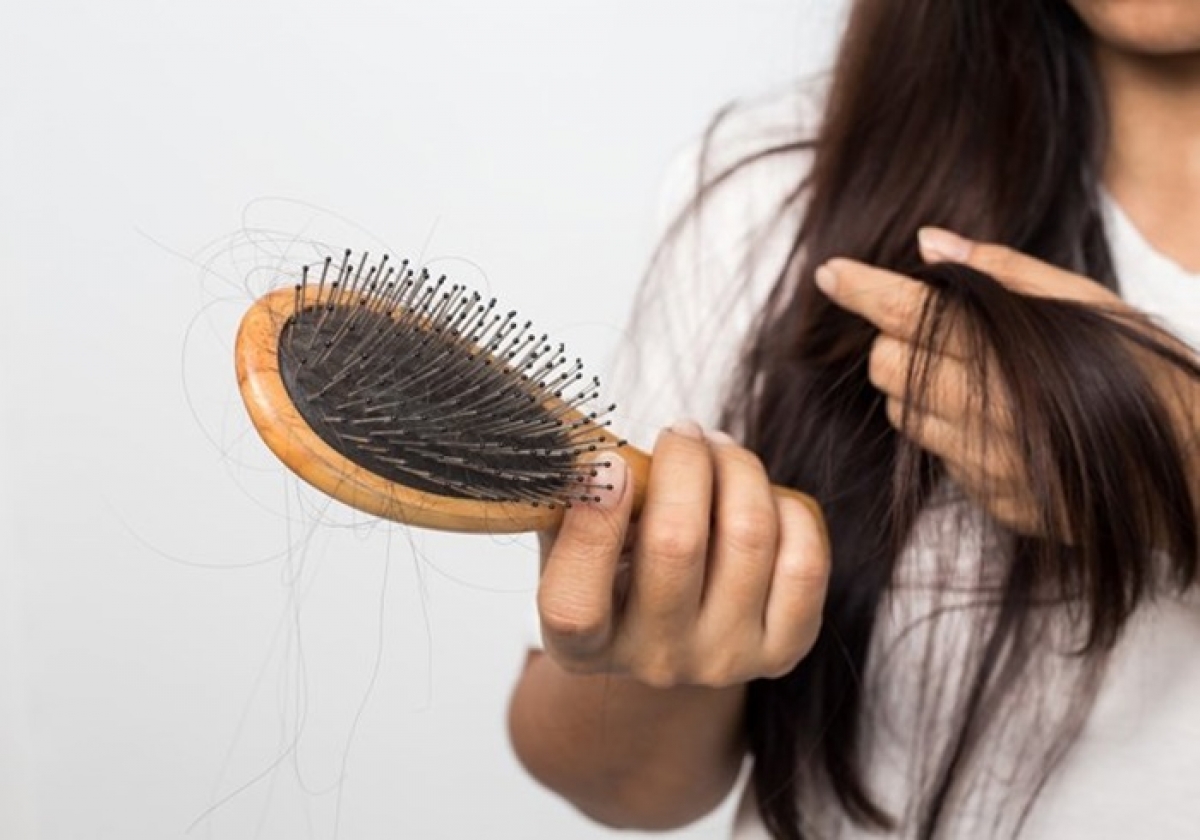 Sữa ong chúa ngăn ngừa tóc gãy rụng