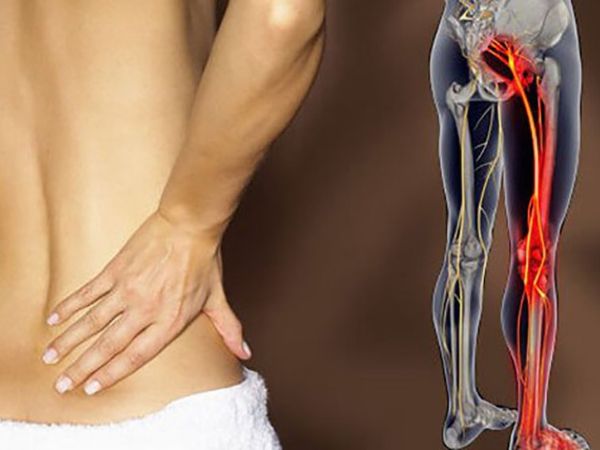 Thần kinh tọa là dây thần kinh dài và dày nhất trong cơ thể