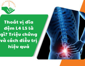 thoat-vi-dia-dem-l4-l5-la-gi-trieu-chung-va-cach-dieu-tri-hieu-qua