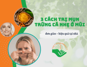 thumbnail-3-cach-tri-mun-trung-ca-nhe-o-mui-don-gian-hieu-qua-tai-nha205