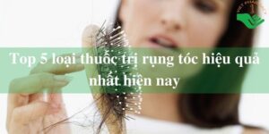 thuoc-tri-rung-toc-hieu-qua-nhat