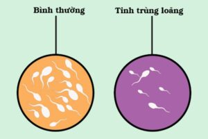 tinh_trung_loang_nhu-the-nao