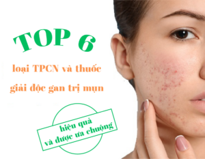 top-6-loai-tpcn-va-thuoc-giai-doc-gan-tri-mun-hieu-qua-va-duoc-ua-chuong