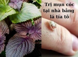 tri-mun-coc-bang-la-tia-to