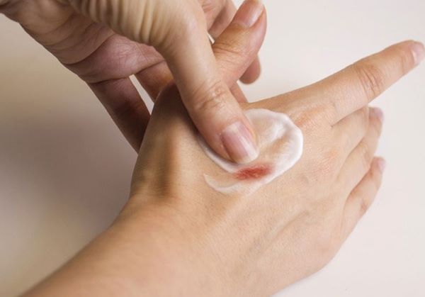 Trị sẹo bằng kem trị sẹo mang lại hiệu quả đáng ngờ