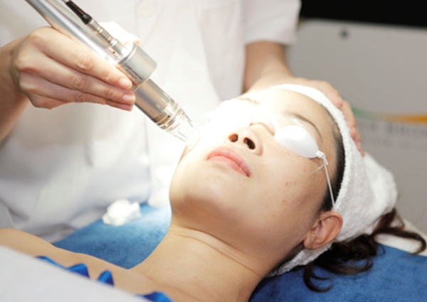Trị sẹo bằng phương pháp chiếu tia laser