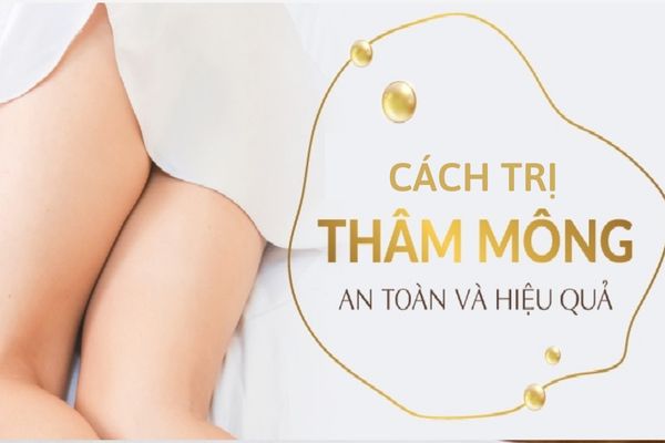 Cách trị thâm mông hiệu quả ngay tại nhà