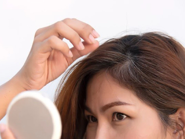 Tóc bạc sớm là gì?