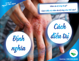 viem-da-di-ung-la-gi-dieu-tri-nhu-the-nao