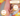 viem-da-tiep-xuc-di-ung-la-gi-cach-dieu-tri-nhu-the-nao