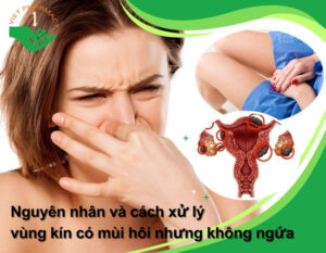 vung-kin-co-mui-hoi-nhung-khong-ngua-thumb