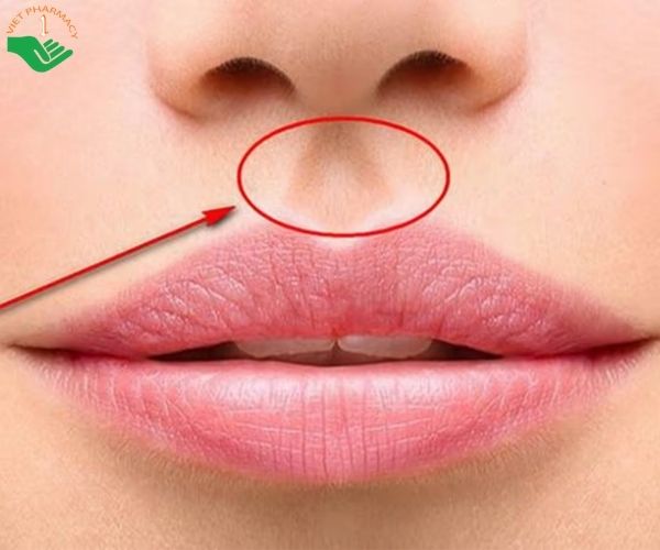 Cách thực hiện vuốt môi trên để hết đau bụng kinh