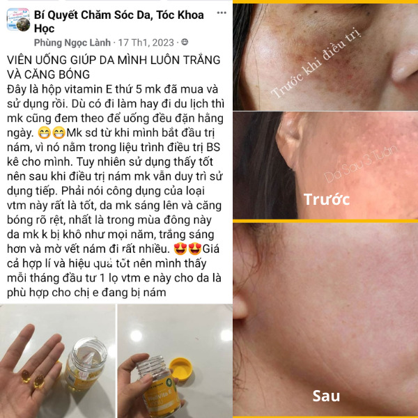 WellVita E - bí quyết cho da tóc sáng khỏe