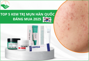 Top 5 kem trị mụn Hàn Quốc​ tốt nhất đáng mua 2025