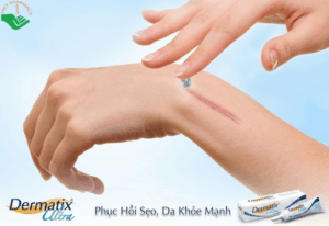 Dermatix Ultra có trị thâm mụn không?