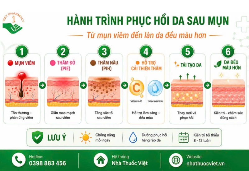 Hành trình phục hồi da sau mụn