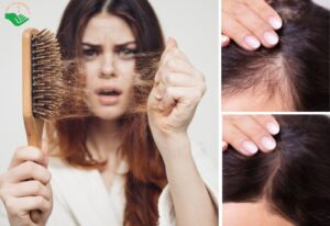 Review 6 sản phẩm dầu gội trị rụng tóc được nhiều dược sĩ khuyên dùng