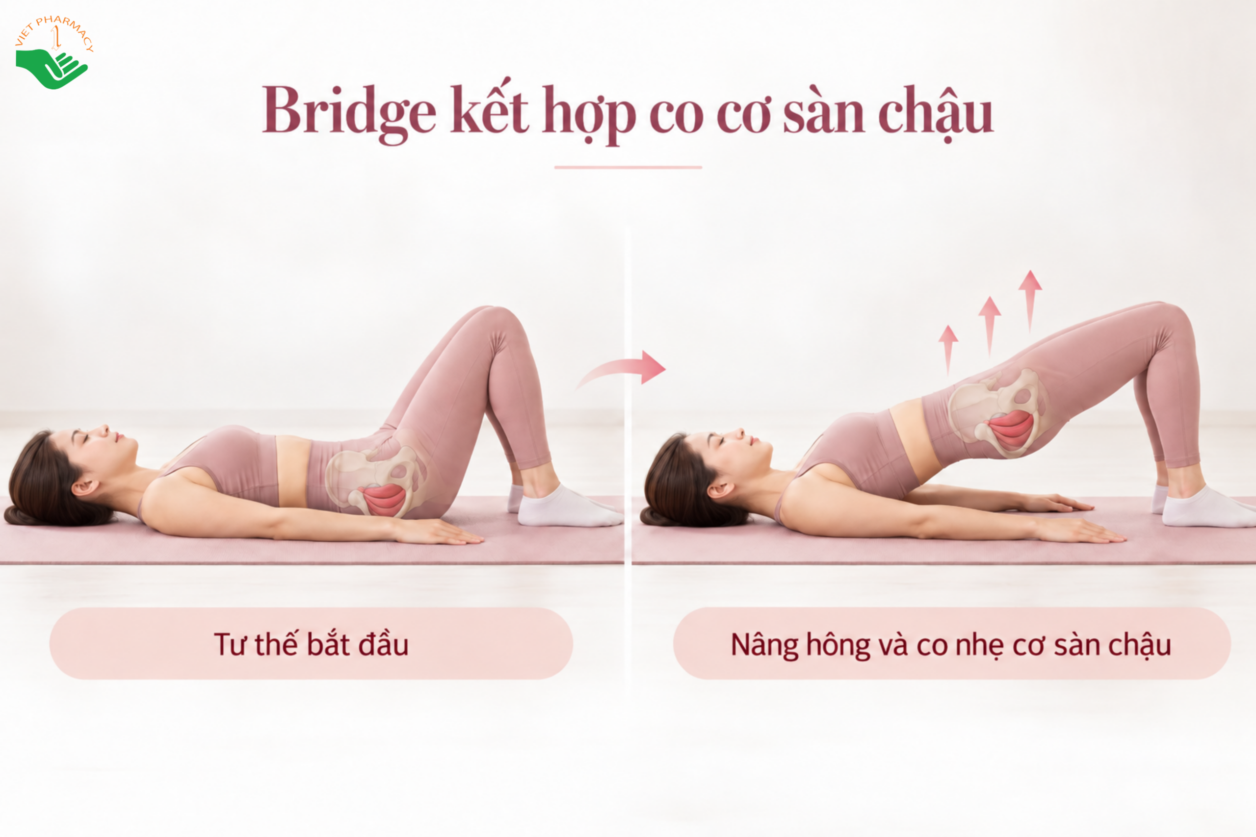 Hướng dẫn bài tập Bridge kết hợp co nhẹ cơ sàn chậu